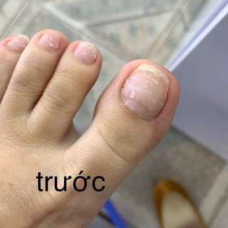 Phục hồi móng CND, dưỡng móng cnd