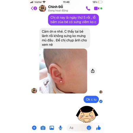 Khuyên bấm lỗ tai cho bé