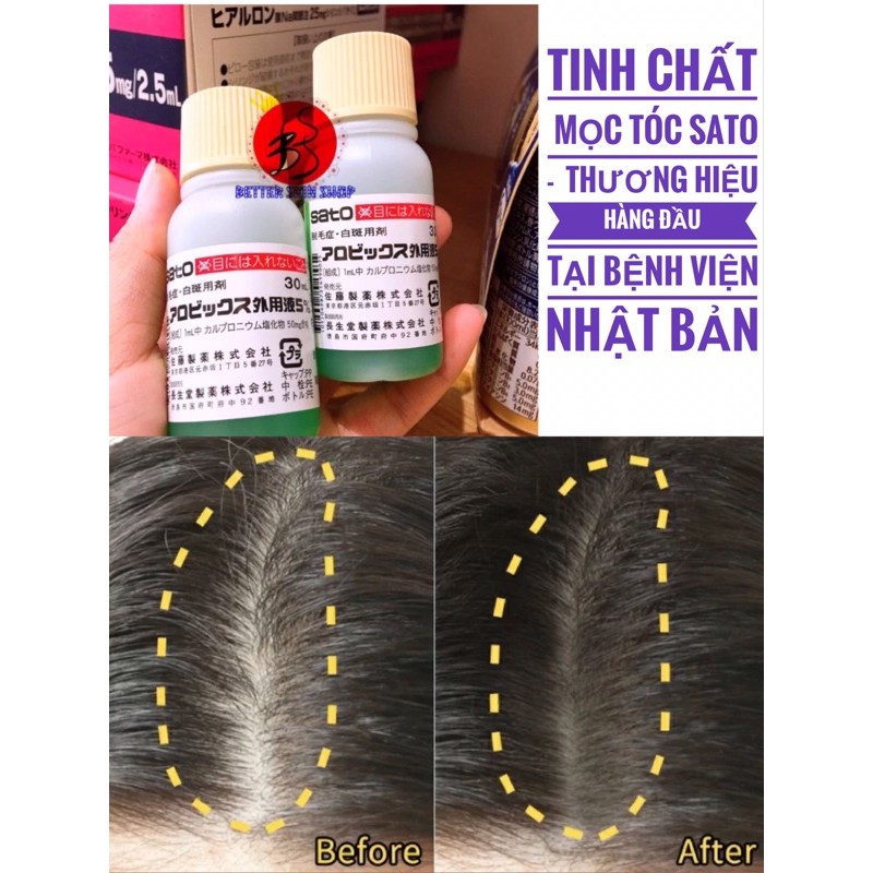 Tinh chất mọc tóc Sato