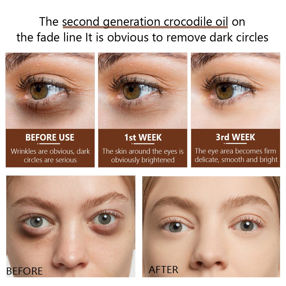 Serum Mắt VIBRANT GLAMOUR Tinh Chất Dầu Cá Sấu Phục Hồi Giảm Nếp Nhăn Bọng Mắt Và Quầng Thâm 30ml | BigBuy360 - bigbuy360.vn