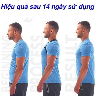 ĐAI CHỐNG GÙ LƯNG CẢI THIỆN CỘT SỐNG