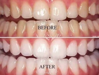 Kem đánh răng trắng sáng Mỹ Ap24