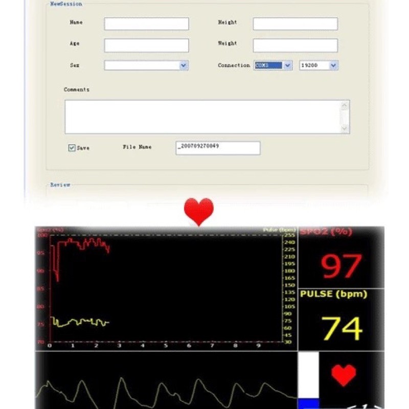 Máy đo SpO2 nhịp tim kẹp ngón tay CMS50E chính hãng xách tay