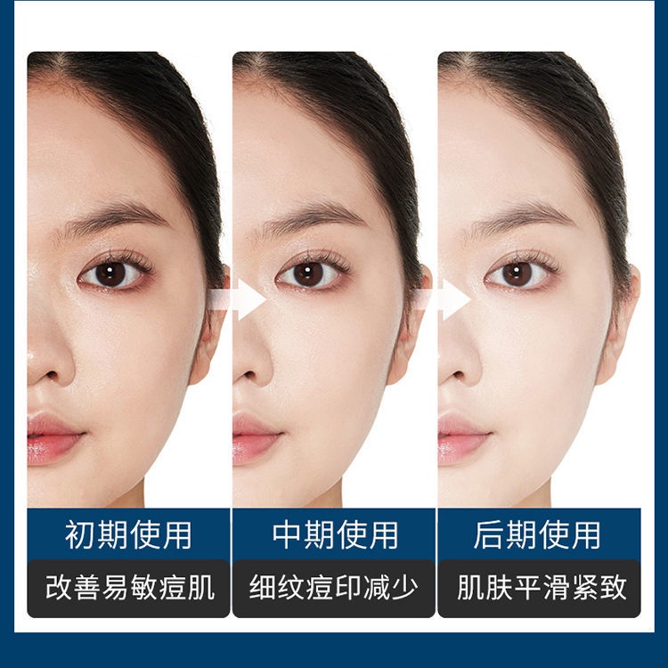Phấn phủ Nicotinamide oligopeptide dưỡng ẩm thu nhỏ lỗ chân lông làm mờ vết thâm đỏ hiệu quả qiaoshueng.11.3 | BigBuy360 - bigbuy360.vn