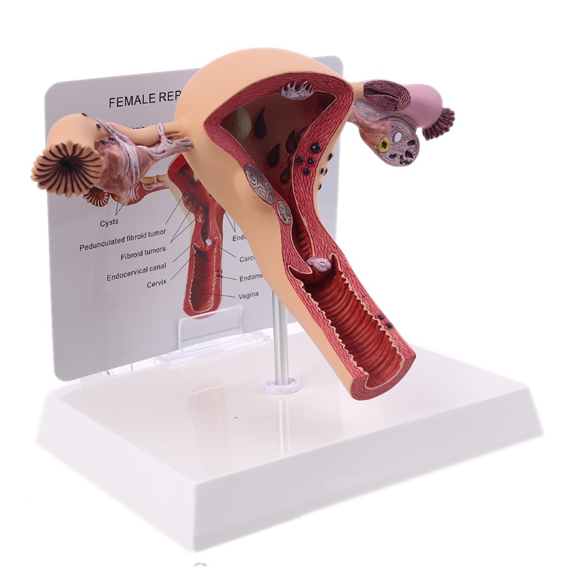 Mô Hình Lối Đi Bệnh tật Bằng Tiếng Ồn Người Phụ Nữ Uterus