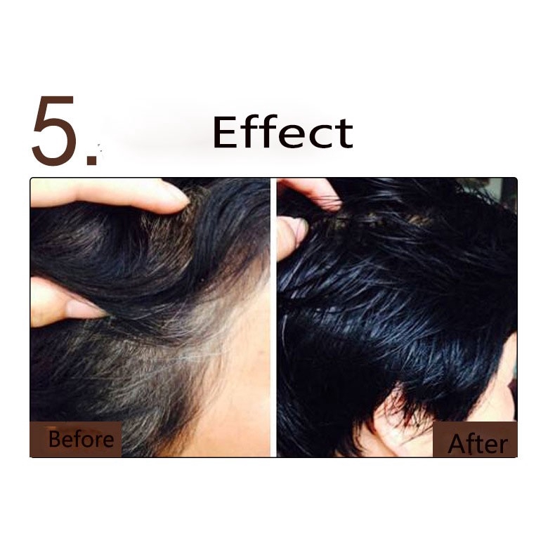 Dầu gội Meidu hỗ trợ nhuộm tóc màu đen tự nhiên | BigBuy360 - bigbuy360.vn