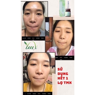 [Chính Hãng] Thảo Mộc Xanh 5ml