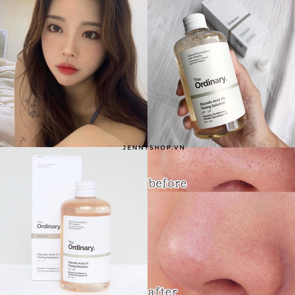 Nước Hoa Hồng The Ordinary Glycolic Acid 7% Toning Solution