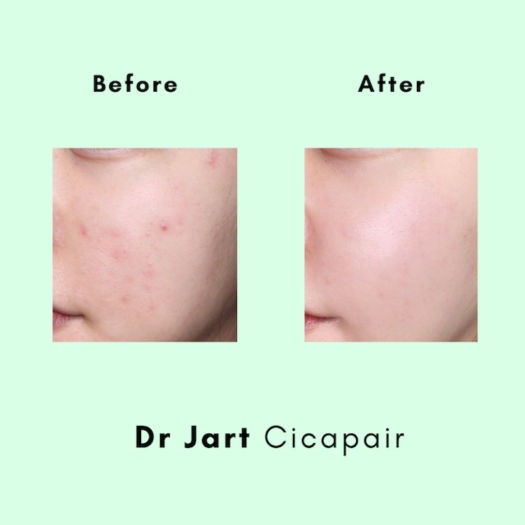 Tinh chất phục hồi da, căng bóng da Dr.Jart+ Cicapair Serum 50ml