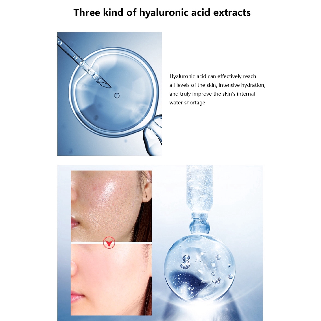 Tinh chất VENZEN axit hyaluronic dưỡng ẩm làm trắng da nâng cơ chống nếp nhăn chăm sóc da khô 15ml