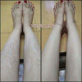 Triệt lông My Miu.