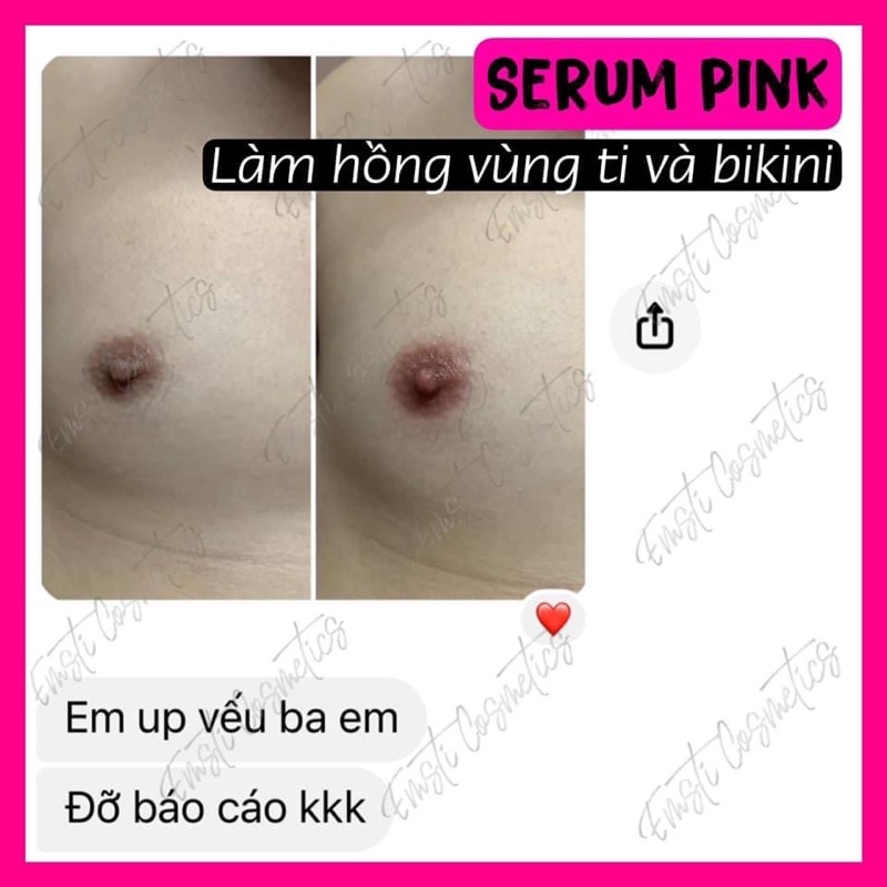 COMBO KEM THÂM & SERUM PINK