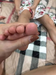 KEM BÔI TRỊ Á SỪNG