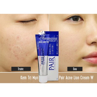 (CÓ BILL) Kem LION PAIR ACNE Nhật Bản