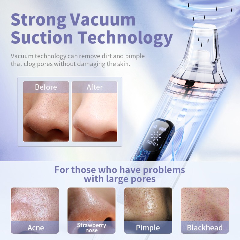 [Mã FMCGMALL - 8% đơn 250K] Máy hút loại bỏ mụn đầu đen ANLAN chống nước làm sạch da mặt | BigBuy360 - bigbuy360.vn
