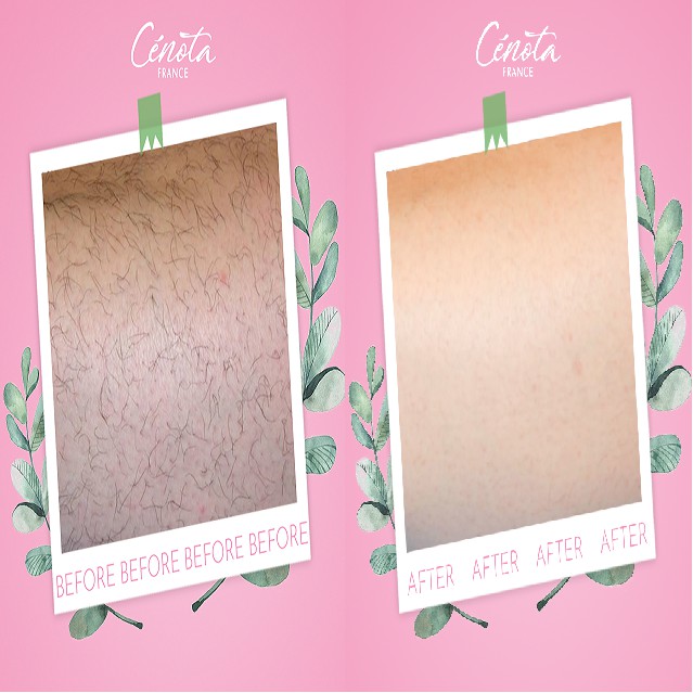 Kem tẩy lông Cenota, kem tẩy lông body, giúp giữ ẩm không gây đau rát | BigBuy360 - bigbuy360.vn