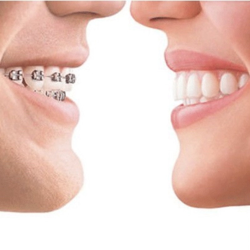 Kem đánh răng niềng răng thảo mộc Thái Lan Derrich herbal Oral làm sạch khử mùi bảo vệ răng nướu