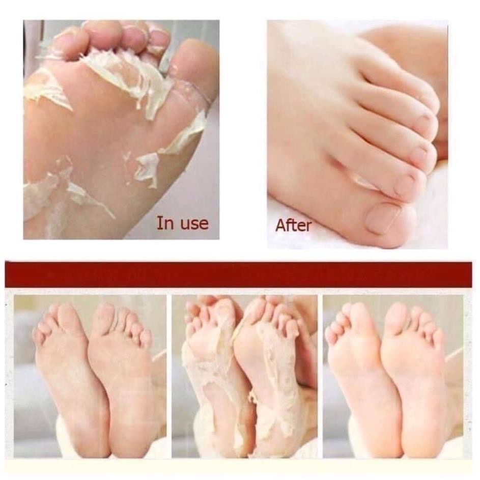 Túi ủ chân tẩy tế bào chết To-plan Foot Care Pack Lavender Nhật