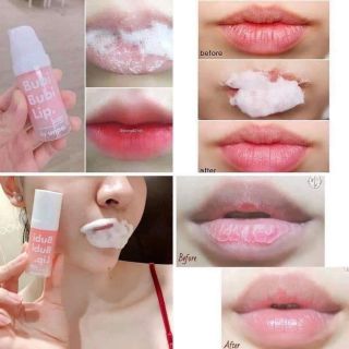 Tẩy tế bào chết môi sủi bọt bubi bubi lip
