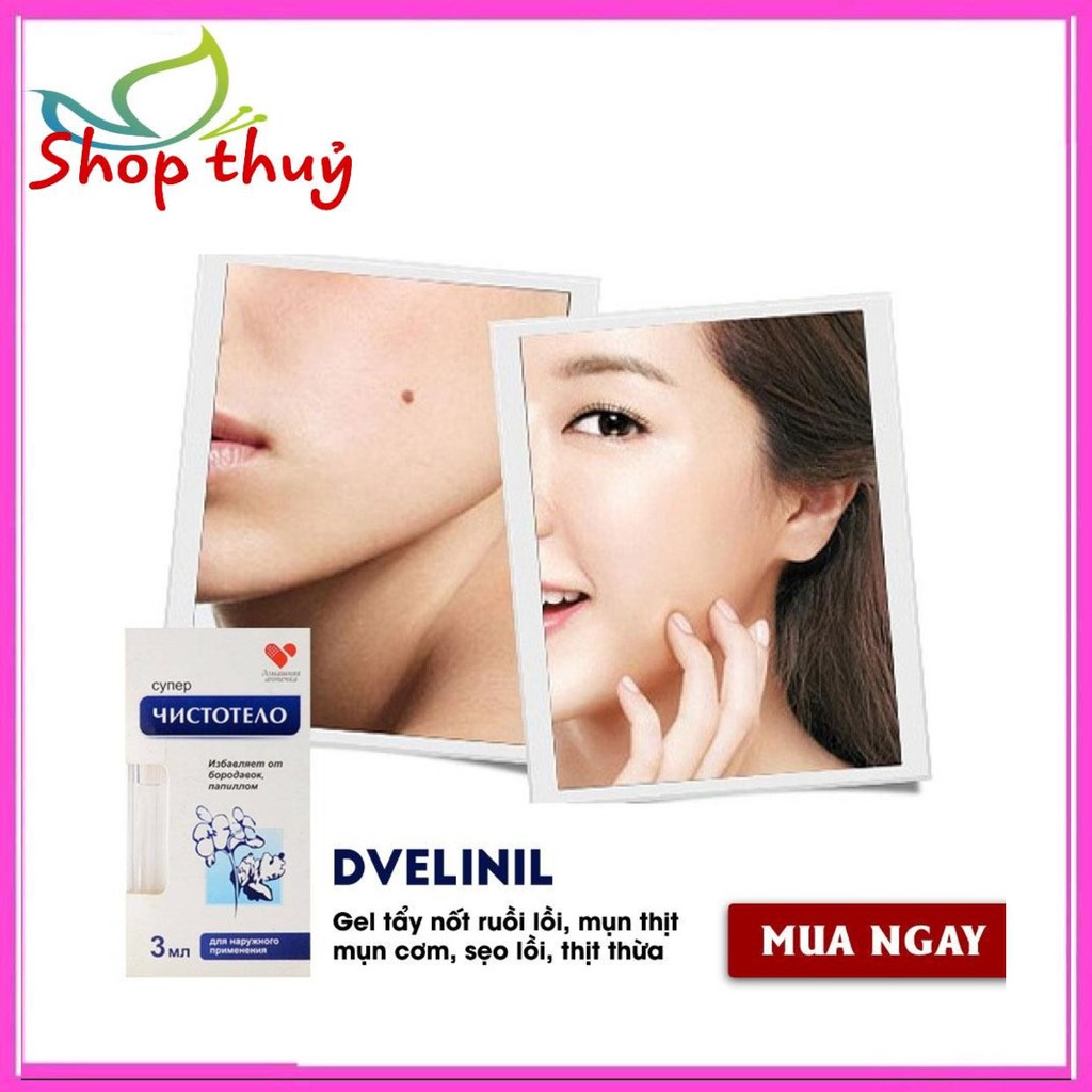 GEL TẨY NỐT RUỒI, MỤN THỊT, MỤN CƠM, MỤN CÓC