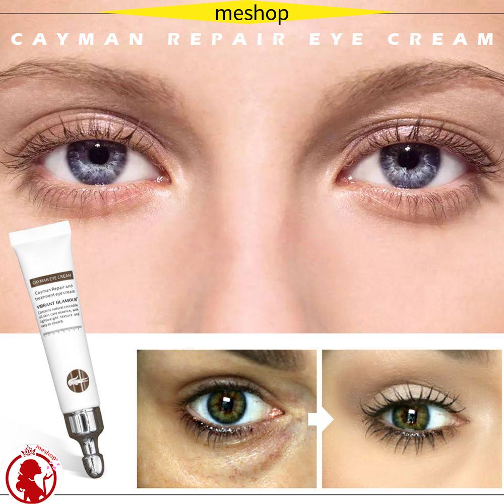 Kem Dưỡng Da Mắt VIBRANT GLAMOUR Loại Bỏ Quầng Thâm Và Bọng Mắt Chống Nếp Nhăn