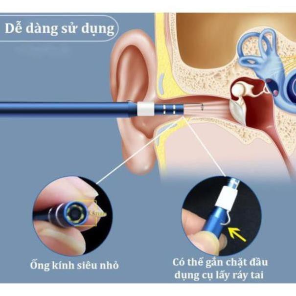 Dụng Cụ Lấy Ráy Tai Có Camera 3 Trong 1, Nội Soi Tai, Mũi Họng - Có App Kết Nối Với Điện Thoại full HD