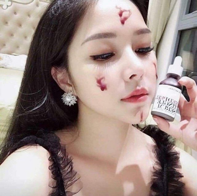 Red Peel Serum Sample