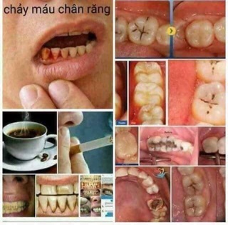 Bột trắng răng Twhite