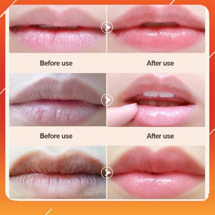 MẶT NẠ MÔI HOA HỒNG DƯỠNG ẨM MỀN MÔI CĂNG MỌNG [hộp 20 miếng]