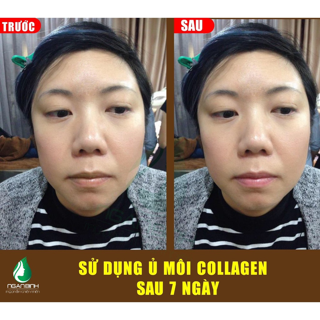 Ủ môi collagen Ngân Bình ,mặt nạ ủ môi,mặt nạ môi dưỡng hồng môi