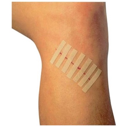 Adhesive Skin Closure - Băng dính dán da Steri Strip thay thế chỉ khâu da 3M Steri Strip trong phẫu thuật tránh giãn sẹo