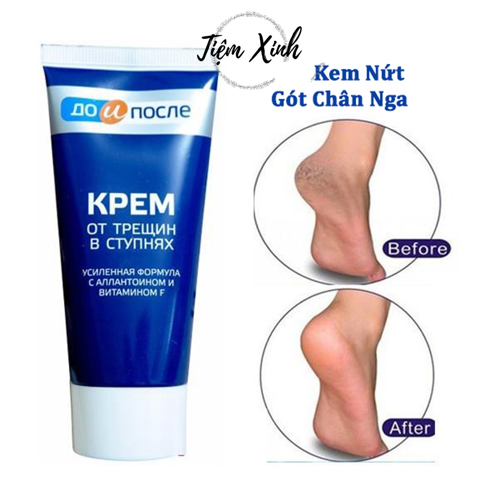 Kem nứt gót chân Kpem Apteka Nga 50ml kem dưỡng da chân, nẻ gót chân, dưỡng da chân mềm mịn