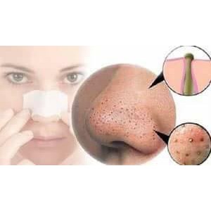 Lột mụn đầu đen