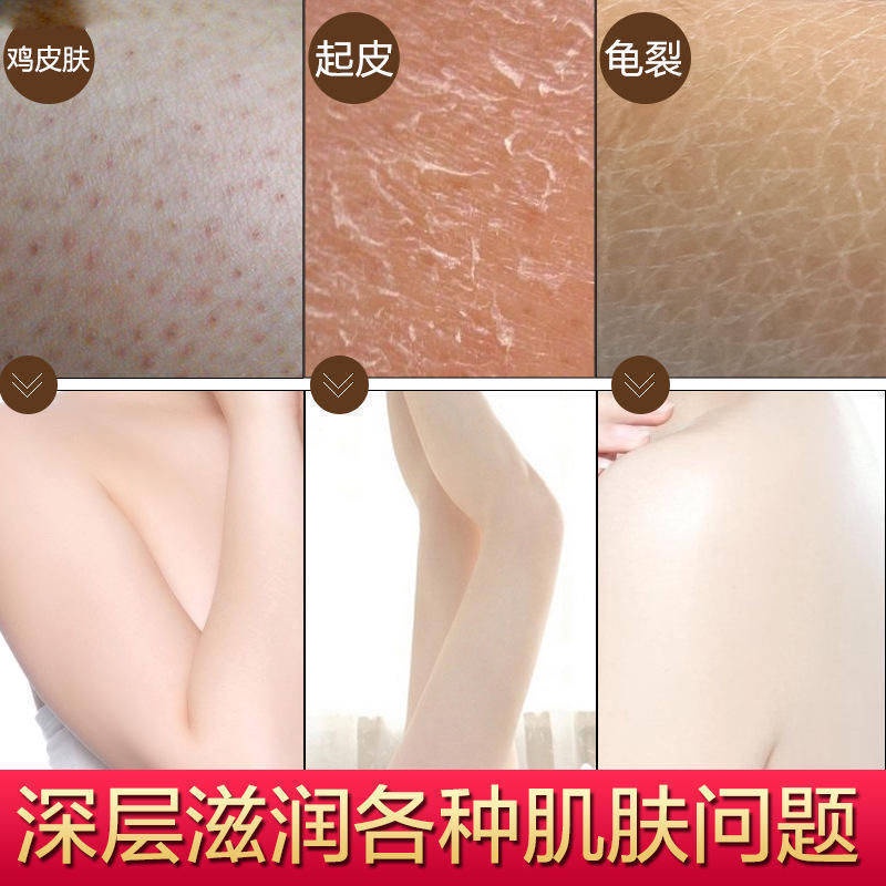 Goosebump Kem Tẩy Tế Bào Chết Toàn Thân Dưỡng Ẩm Làm Trắng Da