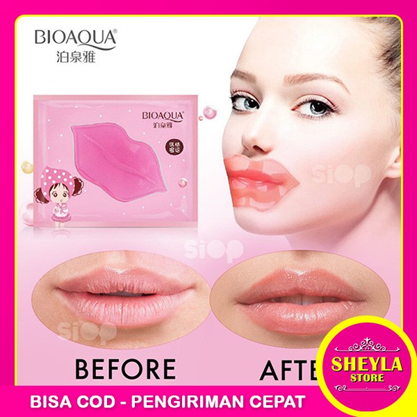 (Hàng Mới Về) Mặt Nạ Môi Bioaqua Collagen Dưỡng Ẩm Môi Ts-74