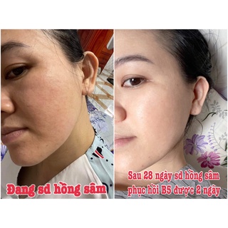 Detox Hồng Sâm DR CELL 50ml tái tạo da mờ thâm nám giảm mụn