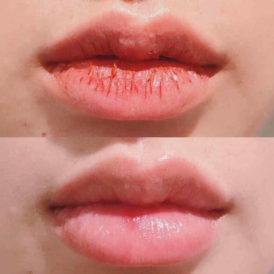 Tẩy Tế Bào Chết Môi, Tẩy da chết môi Beauty Treats Lip Scrub giảm thâm sạm môi dưỡng môi mịn màng tươi sáng