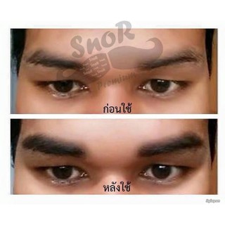 SNOR KÍCH THÍCH MỌC LÔNG RÂU