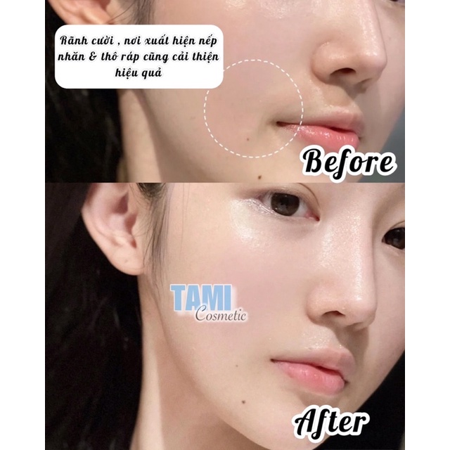 Tinh Chất Smas Pro Vitamin B5 / HA Plus