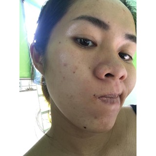 kem dưỡng trắng da