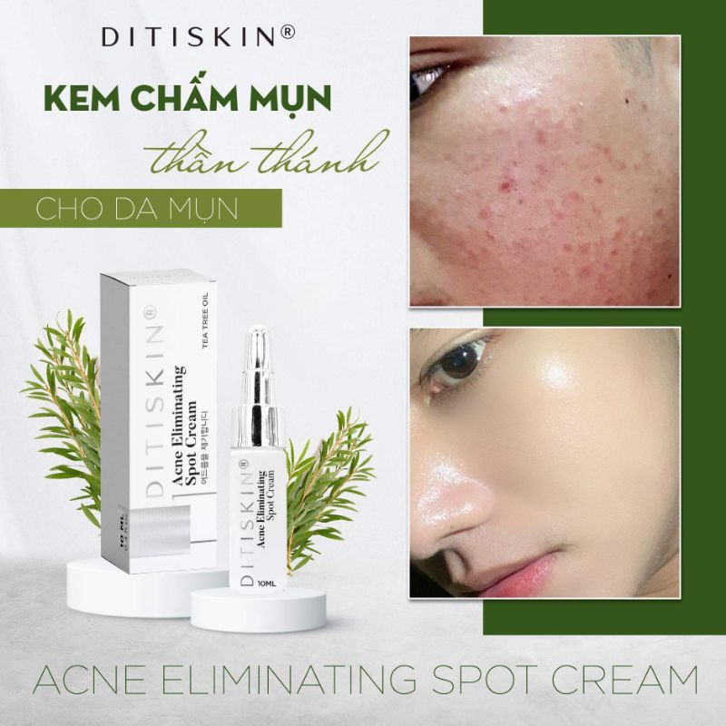 KEM CHẤM MỤN ACNE ELIMINATING SPOT CREAM DITISKIN