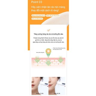 Tinh Chất Trị Thâm Mụn Aprilskin Real Carrot Serum