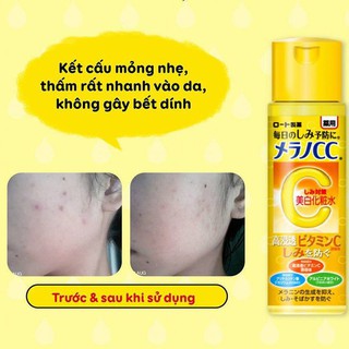 Toner sáng da, mờ thâm Mentholatum CC Melano