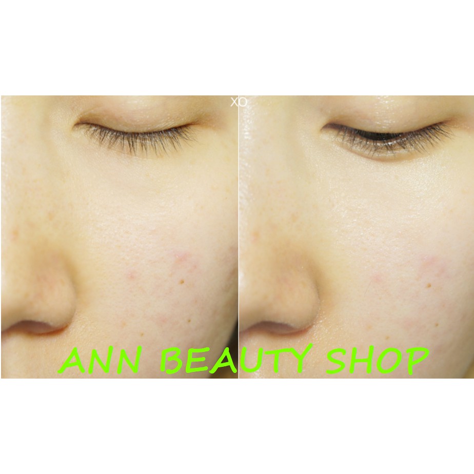 Kem Dưỡng Ẩm Sáng Da I'm from Vitamin Tree Water-gel 75ml | BigBuy360 - bigbuy360.vn