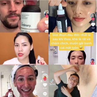 Tẩy tế bào da  AHA 30% + BHA 2% Peeling Solution The Ordinary