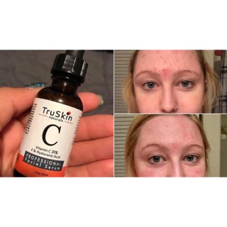 Serum dưỡng da Truskin