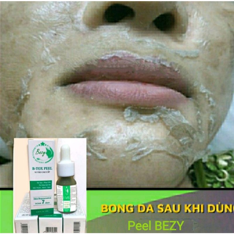 Peel Vi Tảo Tái Tạo Da