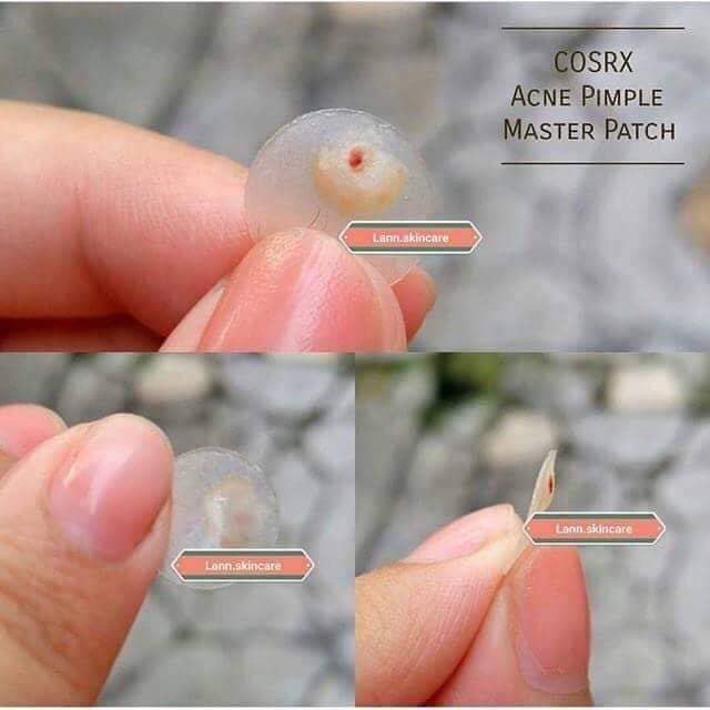 Miếng Dán Mụn Cosrx Clear Fit Master Patch