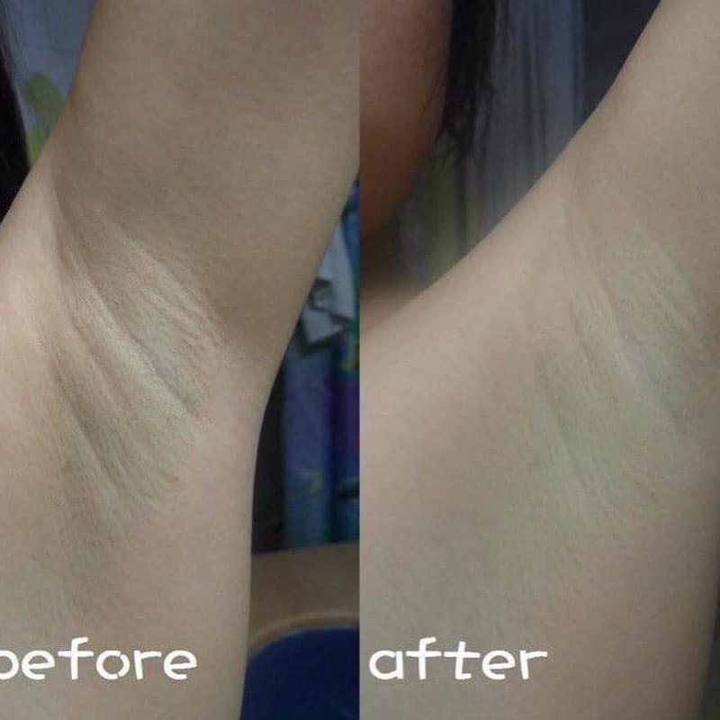 Kem khử thâm nách hôi nách handmade | BigBuy360 - bigbuy360.vn