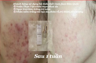 Kem face trắng da Hàn Quốc